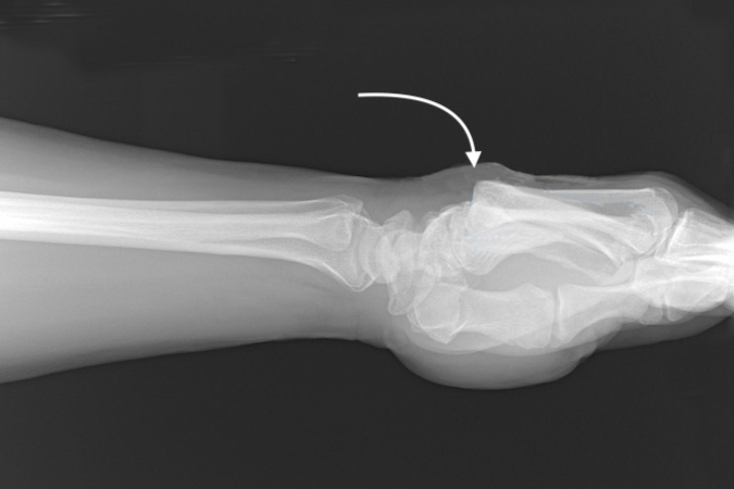Ring and little CMC dislocations (arrow)