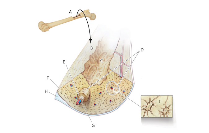 Histology of normal bone:  A = Long bone (femur); B = Harvested section; C = Medullary cavity; D = Osteons; E = Concentric lamellae; F = Circumferential lamellae; G = Central canal with artery (a), vein(v), nerve(n); H = Periosteum; I = Lacunae with osteocytes