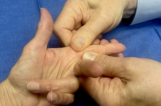 Allen Test for the digital arteries - The examiner's thumbs are compressing both the radial and ulnar digital arteries at the beginning of the test.
