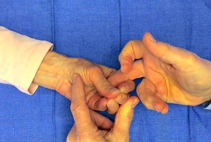 Median Nerve Motor functioning demonstrated by testing thenar muscles.