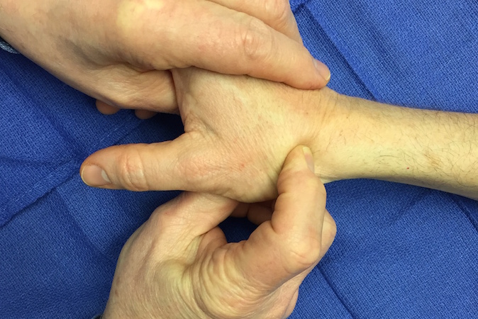 Palpation of scaphoid in anatomic snuff box