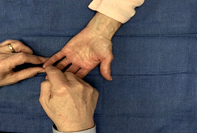 Ulnar nerve sensation being tested at tip of little finger.