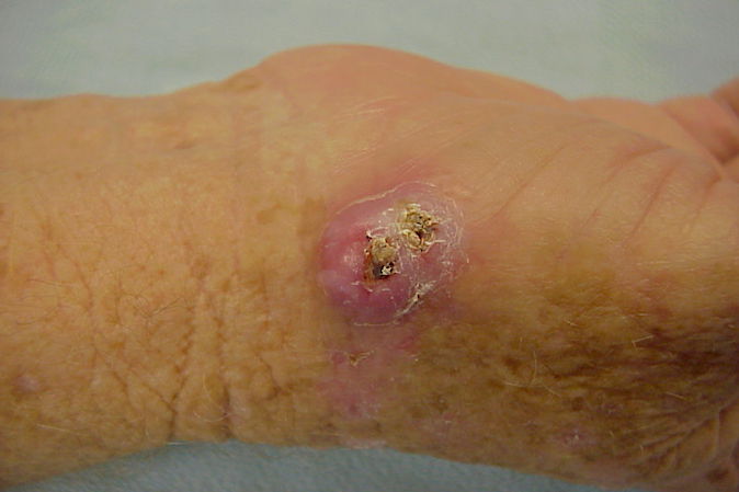 Skin  Hand Surgery Source